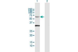 Western Blot analysis of SMAD6 expression in transfected 293T cell line by SMAD6 MaxPab polyclonal antibody. (SMAD6 antibody  (AA 1-496))