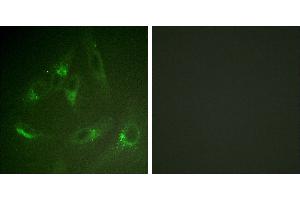 Peptide - +Immunohistochemistry analysis of paraffin-embedded human brain tissue using CSFR (Ab-561) antibody. (CSF1R antibody)