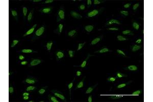 Immunofluorescence of monoclonal antibody to PTTG1 on HeLa cell. (PTTG1 antibody  (AA 93-113))