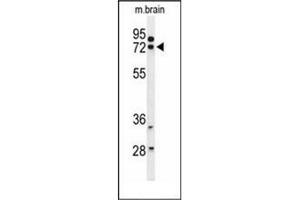 Western blot analysis of HSPA12A Antibody (Center) in mouse brain tissue lysates (35ug/lane). (HSPA12A antibody  (Middle Region))