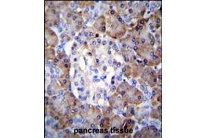TIMP1 Antibody immunohistochemistry analysis in formalin fixed and paraffin embedded human pancreas tissue followed by peroxidase conjugation of the secondary antibody and DAB staining.