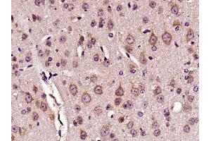 Paraformaldehyde-fixed, paraffin embedded mouse brain, Antigen retrieval by boiling in sodium citrate buffer (pH6) for 15min, Block endogenous peroxidase by 3% hydrogen peroxide for 30 minutes,  Blocking buffer (normal goat serum) at 37°C for 20min, Antibody incubation with DKK3 Polyclonal Antibody (bs-2688R) at 1:400 overnight at 4°C, followed by a conjugated secondary and DAB staining. (DKK3 antibody  (AA 31-130))