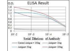 Black line: Control Antigen (100 ng), Purple line: Antigen(10 ng), Blue line: Antigen (50 ng), Red line: Antigen (100 ng), (CRP antibody)