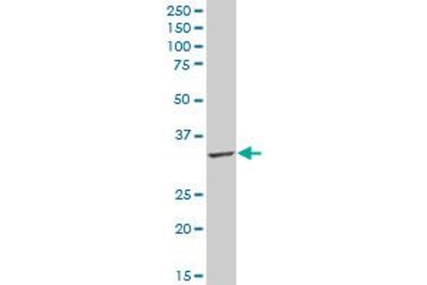 HSD17B3 antibody  (AA 29-119)