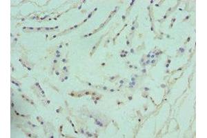 Immunohistochemistry of paraffin-embedded human prostate tissue using ABIN7144586 at dilution of 1:100