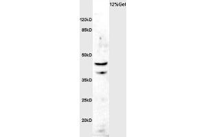 Rat brain lysate probed with Rabbit Anti-ASMTY Polyclonal Antibody, Unconjugated  at 1:3000 for 90 min at 37˚C.