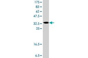 Western Blot detection against Immunogen (37. (ASMT antibody  (AA 71-170))