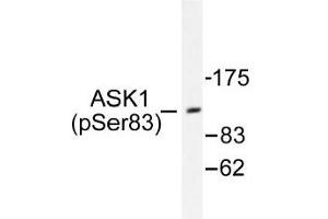 Image no. 1 for anti-Mitogen-Activated Protein Kinase Kinase Kinase 5 (MAP3K5) (pSer83) antibody (ABIN317961) (ASK1 antibody  (pSer83))