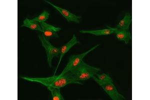 IF analysis of TSEN34 and Tubulin beta using anti-TSEN34 antibody (ABIN7599254) and anti-Tubulin beta antibody (ABIN7602744).