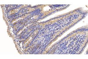 Immunohistochemistry (IHC) image for anti-Lymphocyte Antigen 96 (LY96) (AA 16-160) antibody (ABIN7437365)