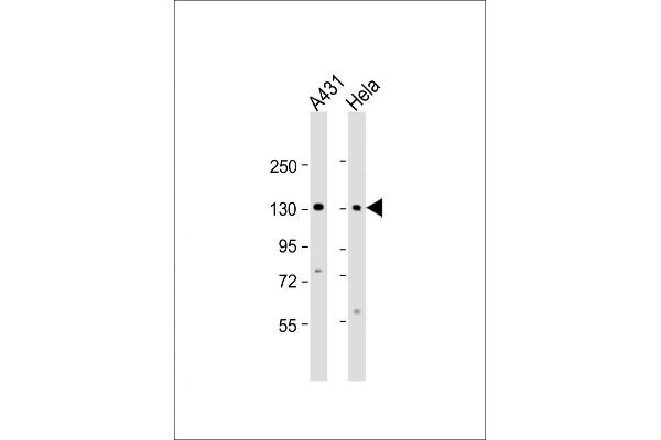 ZBTB11 Antikörper  (C-Term)
