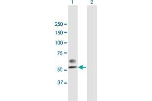 Western Blot analysis of PLA2G3 expression in transfected 293T cell line by PLA2G3 MaxPab polyclonal antibody.