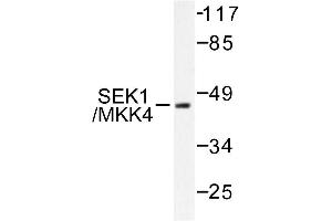 Image no. 1 for anti-Mitogen-Activated Protein Kinase Kinase 4 (MAP2K4) antibody (ABIN271811)