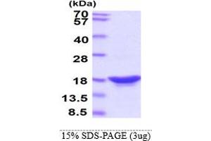 SDS-PAGE (SDS) image for Synuclein, beta (SNCB) protein (ABIN666819)