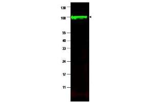 Western blot using  affinity purified anti-iASPP antibody shows detection of a band at ~100 kDa (arrowhead) corresponding to isoform 1 of iASPP in MCF7 whole cell lysates. (PPP1R13L antibody  (Isoform 1))