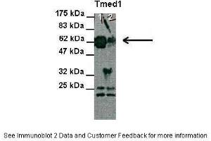 Lanes:   Lane 1 and 2: 30 ug HEK-293 cell lysate  Primary Antibody Dilution:   1:1000  Secondary Antibody:   Anti-Rabbit HRP  Secondary Antibody Dilution:   1:2000  Gene Name:   Tmed1  Submitted by:   Anonymous (TMED1 antibody  (N-Term))