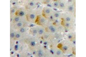 #VALUE! (CD8 alpha antibody  (AA 22-235))