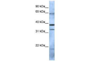 PCGF5 antibody used at 1 ug/ml to detect target protein.