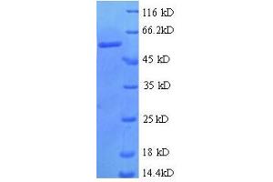 ZNF384 Protein (AA 1-245, partial) (GST tag)