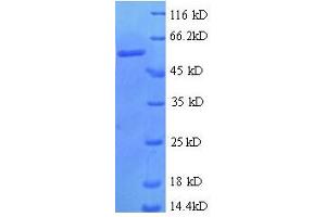 SDS-PAGE (SDS) image for Zinc Finger Protein 384 (ZNF384) (AA 1-245), (partial) protein (GST tag) (ABIN7479611)