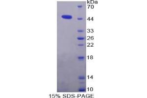 SDS-PAGE of Protein Standard from the Kit (Highly purified E. (Gelsolin ELISA Kit)
