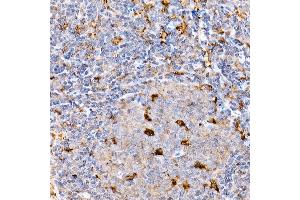 Immunohistochemistry (IHC) image for anti-Interferon alpha/beta Receptor 1 (IFNAR1) (AA 28-290) antibody (ABIN1680393)