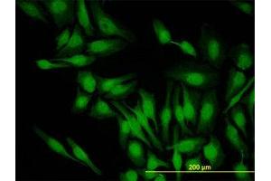 Image no. 2 for anti-PDZ Binding Kinase (PBK) (AA 1-110) antibody (ABIN599275) (PBK antibody  (AA 1-110))