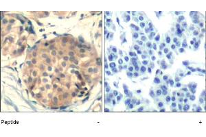 Image no. 1 for anti-Mast/stem Cell Growth Factor Receptor (KIT) (AA 934-938) antibody (ABIN401647) (KIT antibody  (AA 934-938))