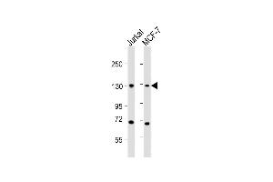 All lanes : Anti-CTCF Antibody (Center) at 1:2000 dilution Lane 1: Jurkat whole cell lysates Lane 2: MCF-7 whole cell lysates Lysates/proteins at 20 μg per lane.