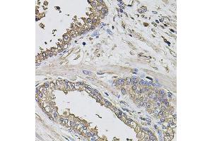 Immunohistochemistry of paraffin-embedded human prostate using GRN antibody (ABIN6292502) at dilution of 1:100 (40x lens).