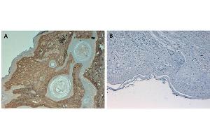 Immunohistochemistry (IHC) image for anti-Collagen, Type I, alpha 1 (COL1A1) antibody (FITC) (ABIN5596822)
