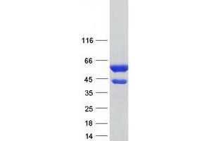 Validation with Western Blot (CAP1 Protein (Transcript Variant 2) (Myc-DYKDDDDK Tag))