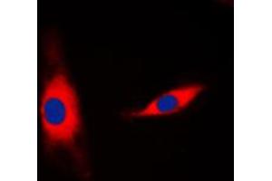 Immunofluorescent analysis of Mammaglobin B staining in HepG2 cells.