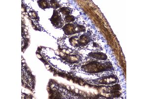 IHC analysis of POLR2A using anti-POLR2A antibody . (POLR2A/RPB1 antibody  (AA 1148-1384))