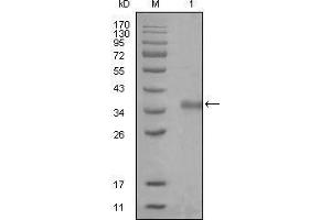 Western blot analysis using NCOR1 mouse mAb against truncated Trx-NCOR1 recombinant protein (1). (NCOR1 antibody  (AA 1-192))