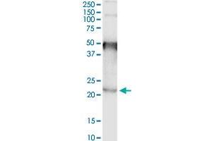 Immunoprecipitation of TMEM86B transfected lysate using anti-TMEM86B MaxPab rabbit polyclonal antibody and Protein A Magnetic Bead , and immunoblotted with . (TMEM86B antibody  (AA 1-226))