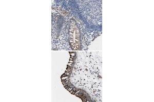 Immunohistochemical staining of human nasopharynx with TWISTNB polyclonal antibody  shows strong cytoplasmic and membranous positivity in respiratory epithelial cells at 1:200-1:500 dilution. (TWIST Neighbor antibody)