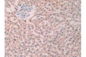 IHC-P analysis of Rat Liver Tissue, with DAB staining. (SLIT1 antibody  (AA 308-512))