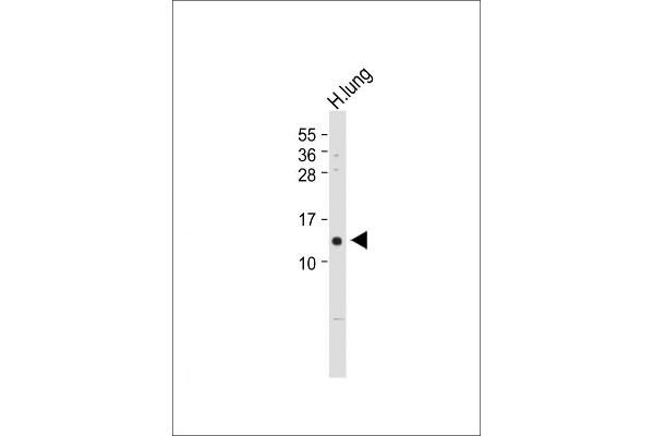 VKORC1 antibody  (N-Term)