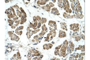 RHOT1 antibody was used for immunohistochemistry at a concentration of 4-8 ug/ml. (RHOT1 antibody  (N-Term))