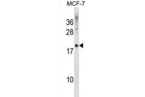 Western Blotting (WB) image for anti-CKLF-Like MARVEL Transmembrane Domain Containing 5 (CMTM5) antibody (ABIN2999517)