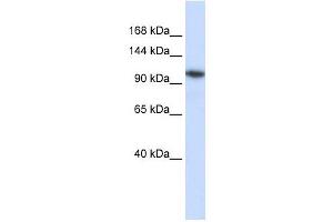 B4GALNT3 antibody used at 1 ug/ml to detect target protein. (B4GALNT3 antibody  (N-Term))