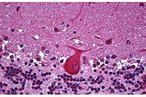 Human Brain, Cerebellum: Formalin-Fixed, Paraffin-Embedded (FFPE) (TNF alpha antibody  (AA 1-234))