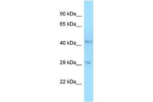 WB Suggested Anti-B4galt3 Antibody   Titration: 1. (B4GALT3 antibody  (C-Term))