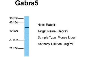 Host: Rabbit Target Name: Gabra5 Sample Tissue: Mouse Liver Antibody Dilution: 1.