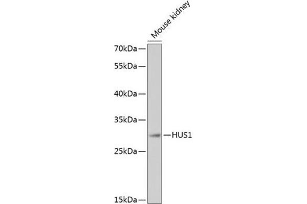 HUS1 antibody  (AA 1-280)