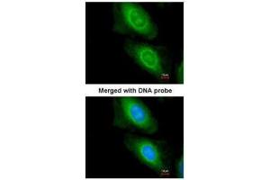 ICC/IF Image Immunofluorescence analysis of paraformaldehyde-fixed HeLa, using MCD, antibody at 1:200 dilution.