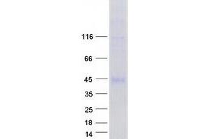 Western Blotting (WB) image for Fibroblast Growth Factor Receptor 1 (FGFR1) (Transcript Variant 6) protein (Myc-DYKDDDDK Tag) (ABIN2721164)