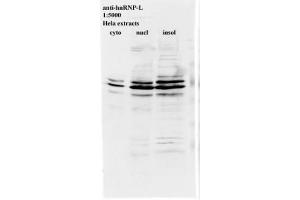 Image no. 2 for anti-Heterogeneous Nuclear Ribonucleoprotein L (HNRNPL) antibody (ABIN108588) (HNRNPL antibody)
