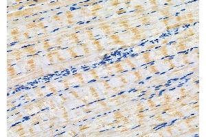 ABIN6266160 and ABIN6277132 at 1/100 staining Rat muscle tissue by IHC-P. (EIF2C3 antibody  (Internal Region))